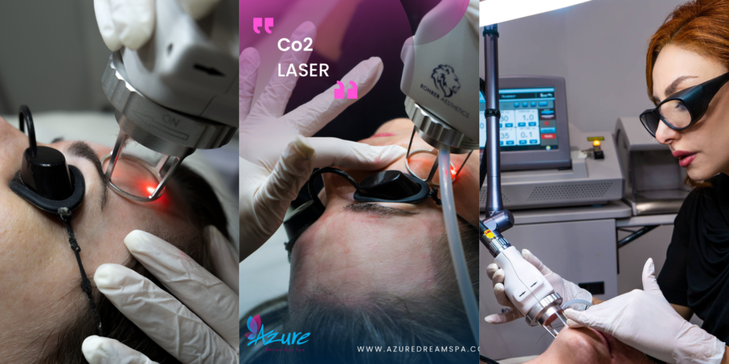 CO2 Laser Resurfacing in Arlington VA