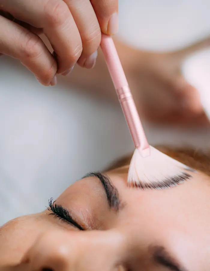 Chemical Peel pigmentation Treatment