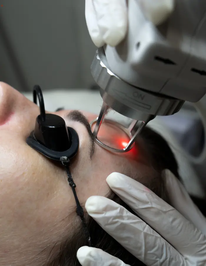 Co2 pigmentation treatment