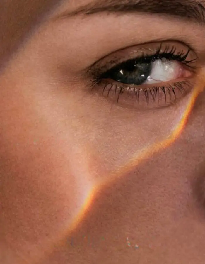 ipl pigmentation treatment